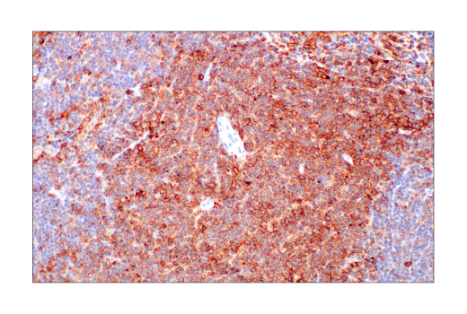 Immunohistochemistry Image 7: Integrin beta2 (E9O7W) Rabbit Monoclonal Antibody (BSA and Azide Free)