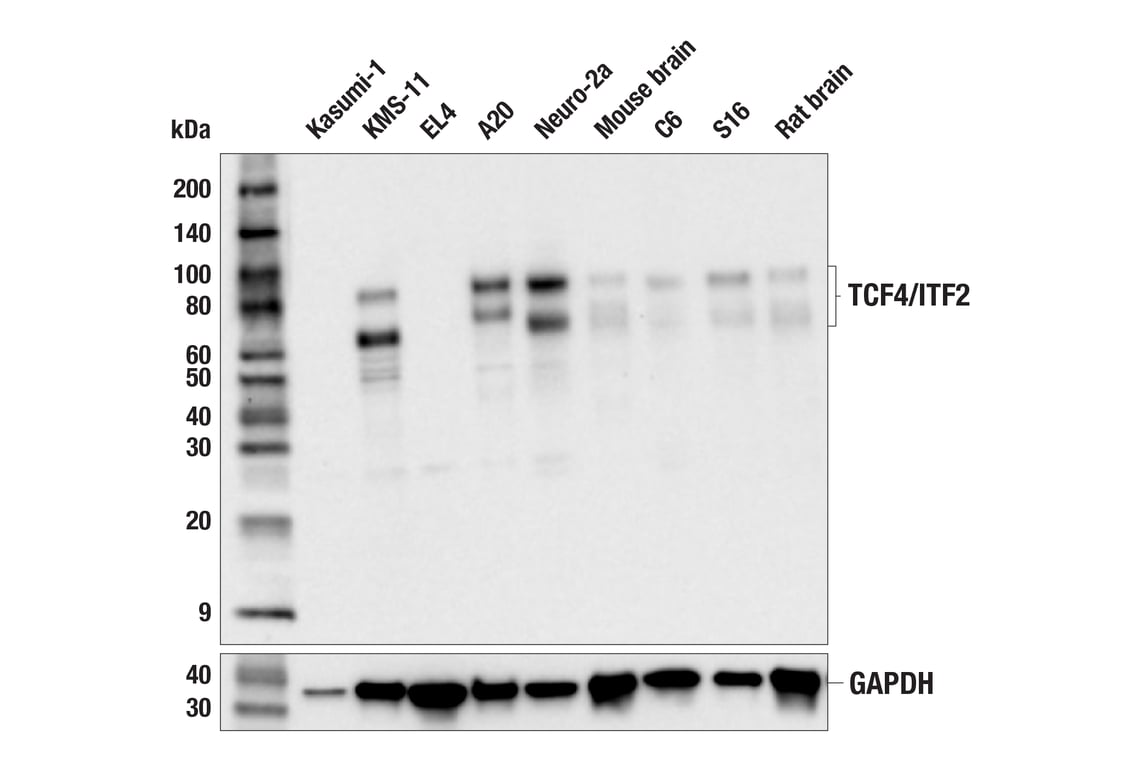 Western Blotting Image 2: TCF4/ITF2 (E3X2Y) Rabbit Monoclonal Antibody