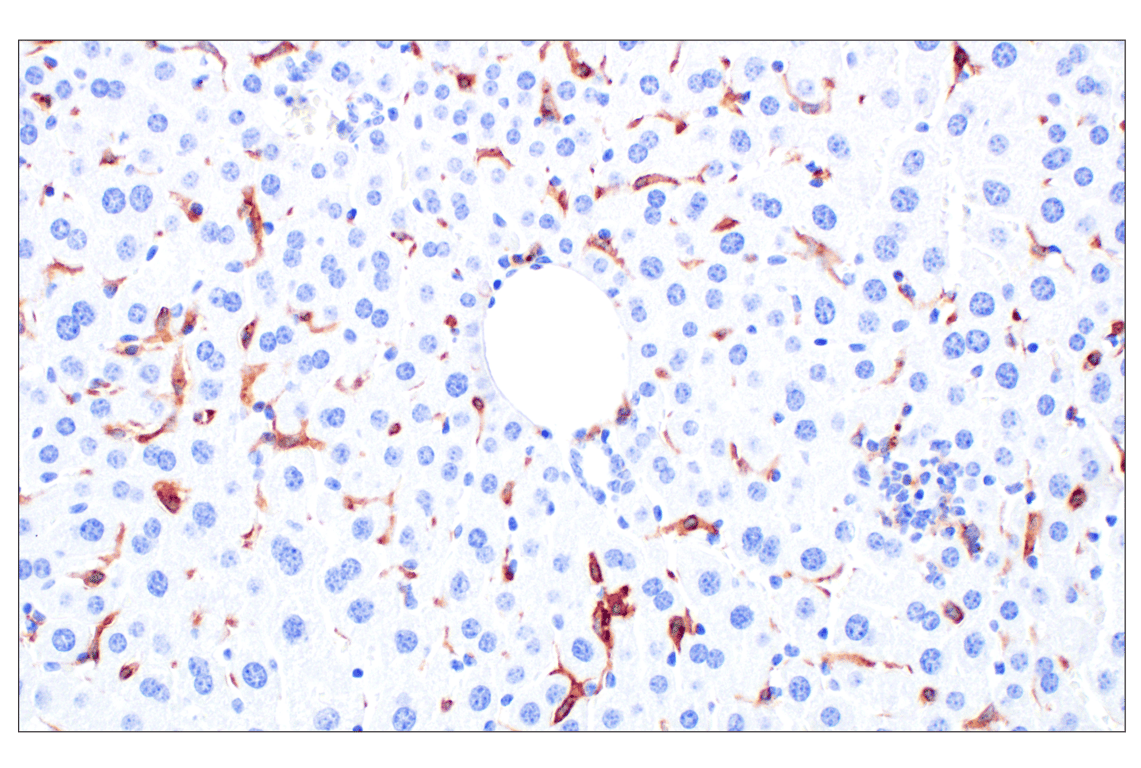 はな CSF-1R/M-CSF-R (F1H1I) Rabbit Monoclonal Antibody | Cell Signaling