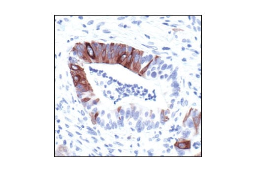 Immunohistochemistry Image 2: Phospho-NF-kappaB p105 (Ser932) (178F3) Rabbit Monoclonal Antibody