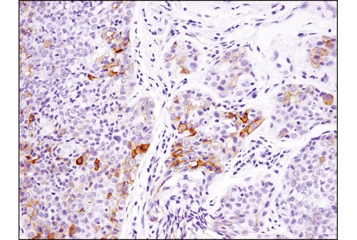 Immunohistochemistry Image 2: B7-H4 (D1M8I) Rabbit Monoclonal Antibody