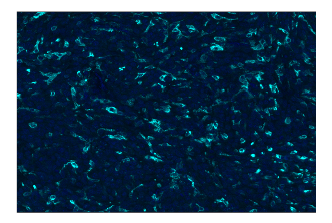 Immunohistochemistry Image 2: CD206/MRC1 (E6T5J) Rabbit Monoclonal Antibody (Alexa Fluor<sup>®</sup> 750 Conjugate)
