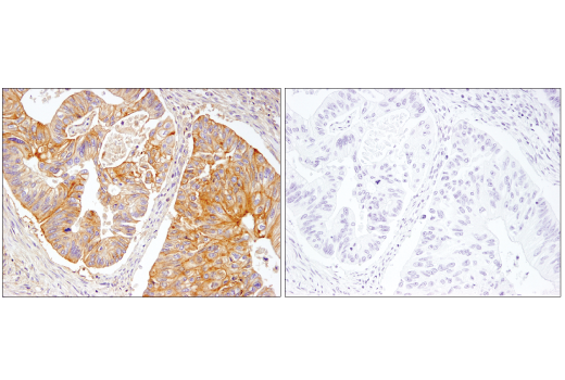 Immunohistochemistry Image 2: beta2-microglobulin (D8P1H) Rabbit Monoclonal Antibody (BSA and Azide Free)