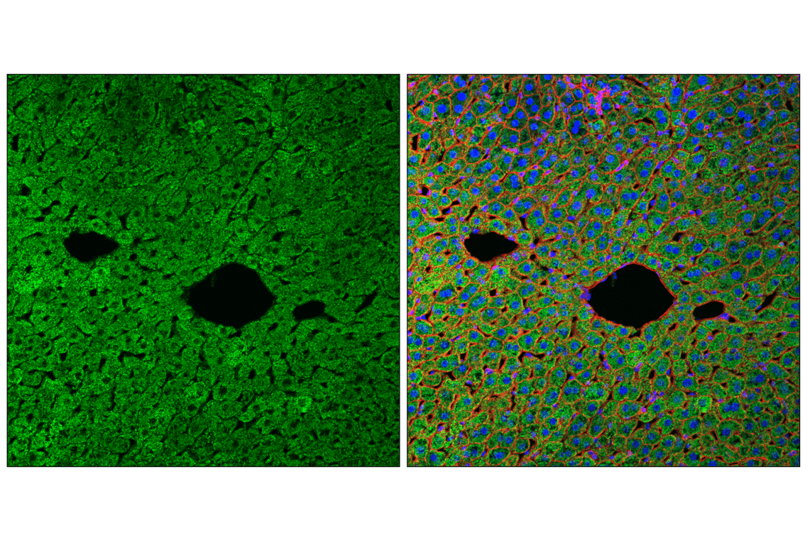Immunofluorescence Image 1: SLC25A1 (E7B2B) Rabbit Monoclonal Antibody