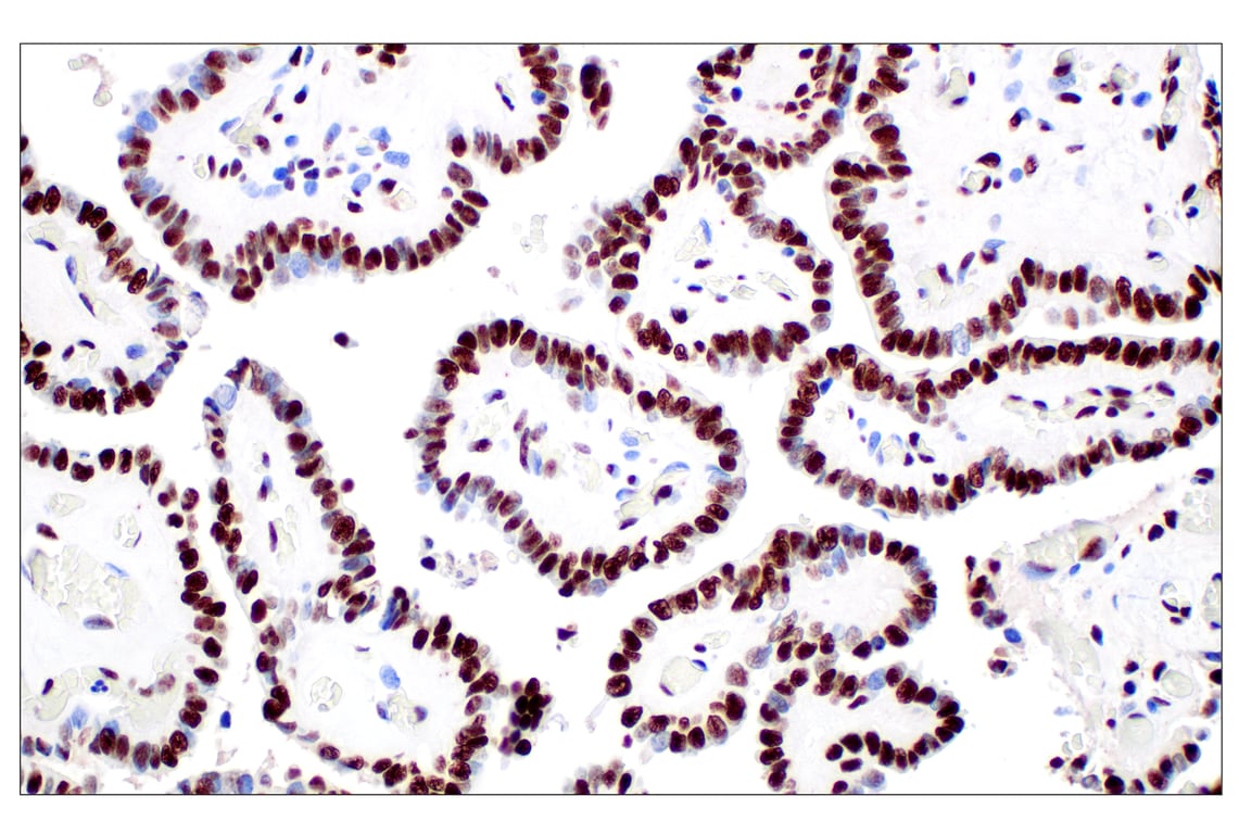 Immunohistochemistry Image 2: NPM1 (E7W4P) Rabbit Monoclonal Antibody