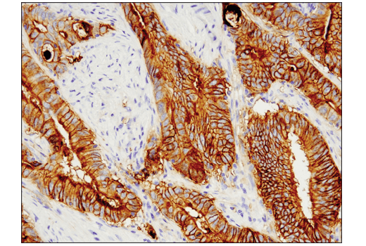 Immunohistochemistry Image 1: Tissue Factor/CD142 (E9M6T) Rabbit Monoclonal Antibody (BSA and Azide Free)