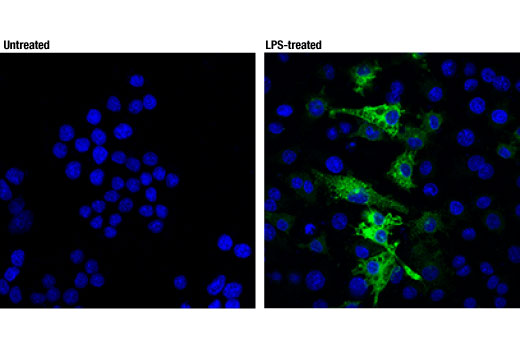 Immunofluorescence Image 1: iNOS (D6B6S) Rabbit mAb (Alexa Fluor<sup>®</sup> 488 Conjugate)