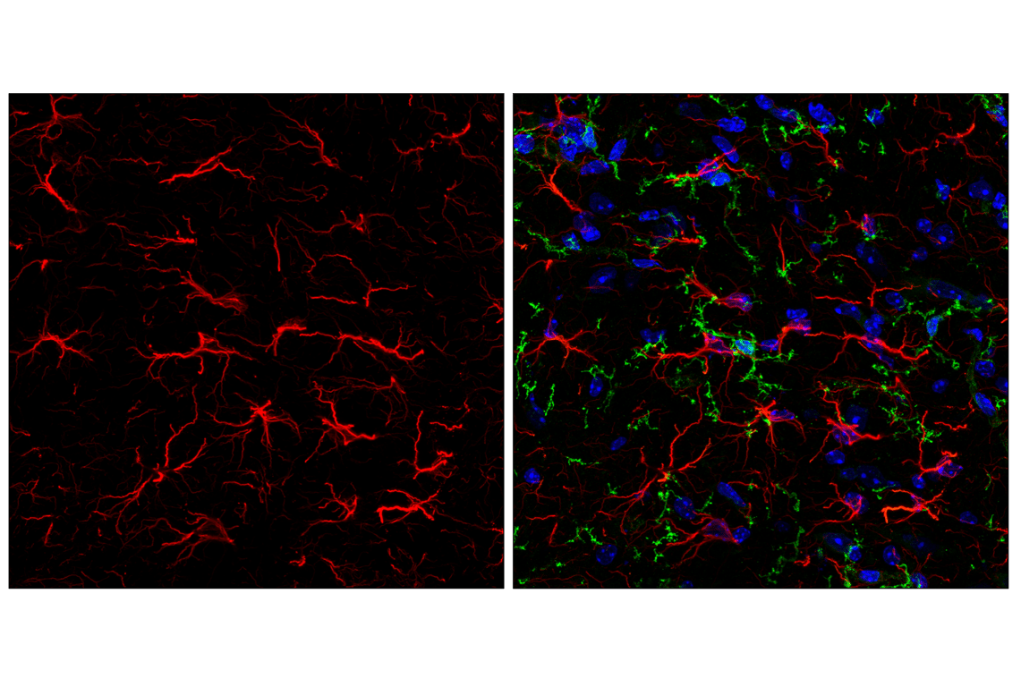 Immunofluorescence Image 1: GFAP (E4L7M) Rabbit Monoclonal Antibody (Alexa Fluor<sup>®</sup> 555 Conjugate)