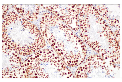 Immunohistochemistry Image 7: Ezh2 (D2C9) Rabbit Monoclonal Antibody (BSA and Azide Free)