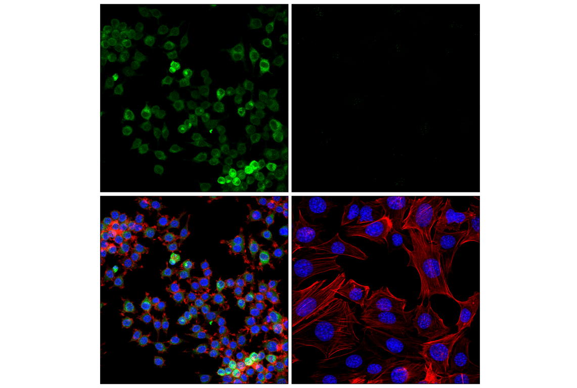 Immunofluorescence Image 1: CD74 (F6K1S) Rabbit Monoclonal Antibody