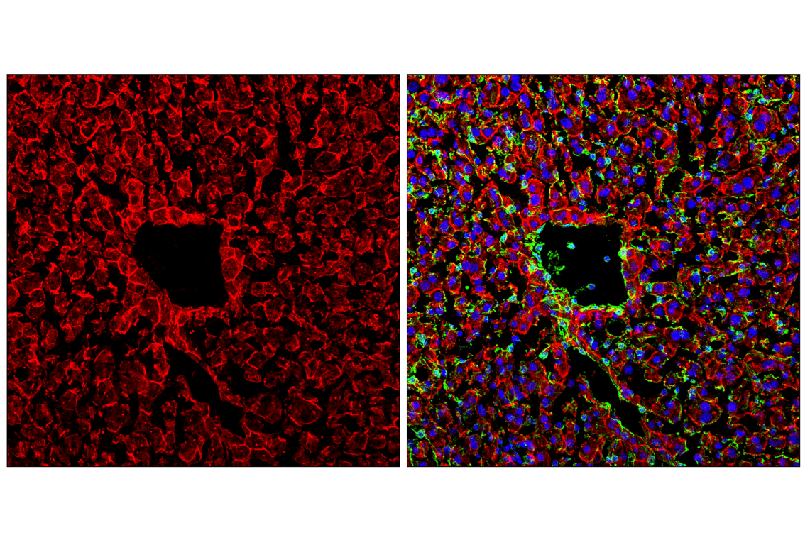 Immunofluorescence Image 1: Pan-Keratin (C11) Mouse mAb (Alexa Fluor<sup>®</sup> 555 Conjugate)