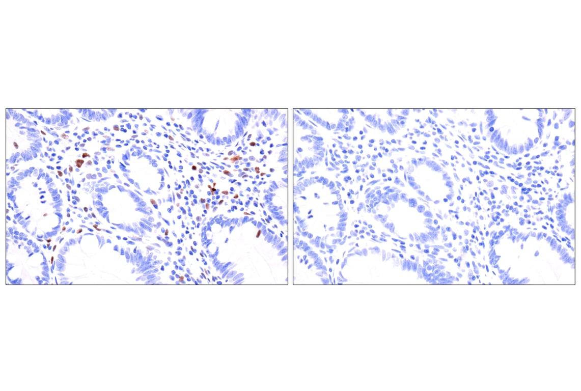 Immunohistochemistry Image 11: BATF3 (E3F3L) Rabbit Monoclonal Antibody (BSA and Azide Free)