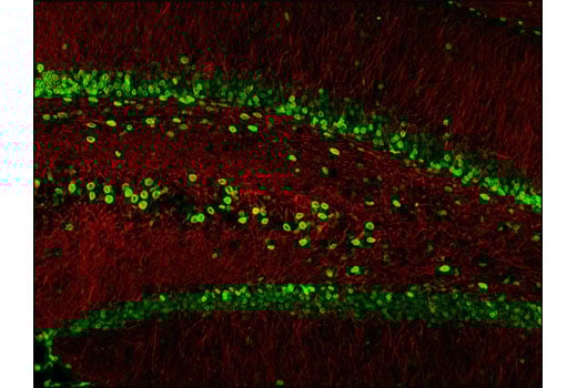 Immunofluorescence Image 1: Lamin A/C (4C11) Mouse Monoclonal Antibody (BSA and Azide Free)