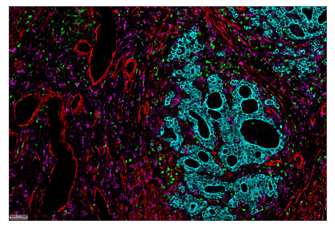 Immunohistochemistry Image 5: SignalStar<sup>™</sup> Miniplex IHC Buffer Kit