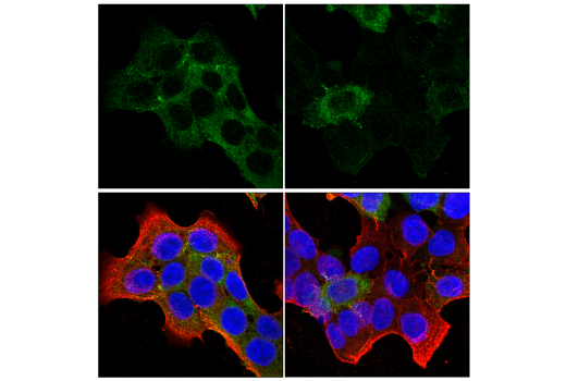 Immunofluorescence Image 1: PAK4 (E7H7R) Rabbit Monoclonal Antibody