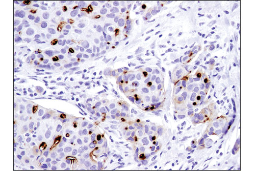 Immunohistochemistry Image 1: CD133 (D4W4N) Rabbit Monoclonal Antibody