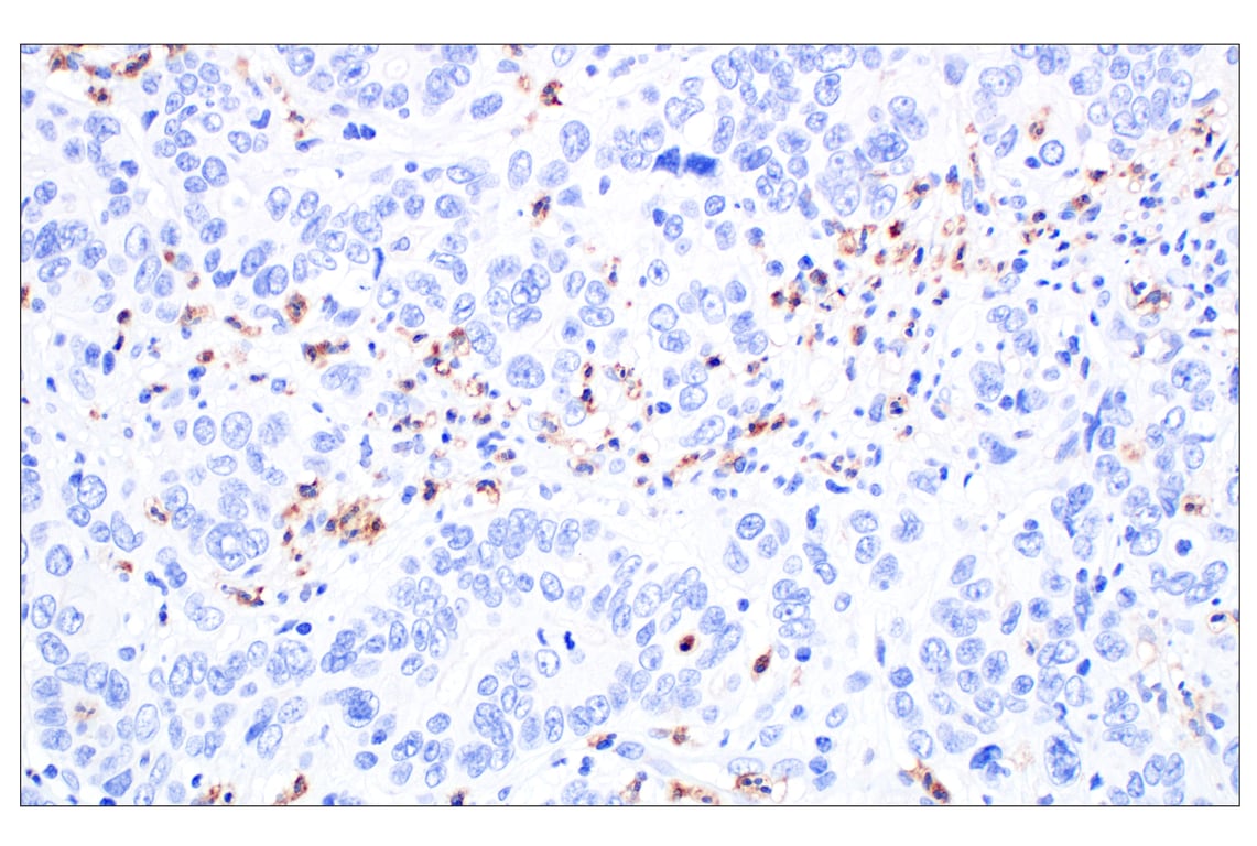 Immunohistochemistry Image 4: CD89/FCAR (F1T9J) Rabbit Monoclonal Antibody