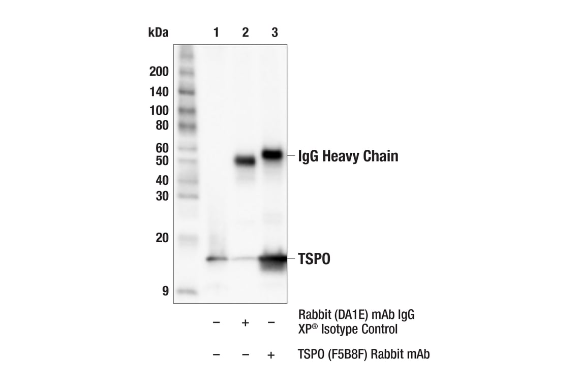 Immunoprecipitation Image 1: TSPO (F5B8F) Rabbit Monoclonal Antibody