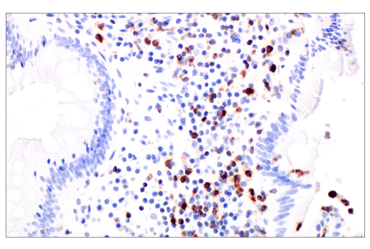 Immunohistochemistry Image 5: Glut3 (E7M7V) Rabbit Monoclonal Antibody