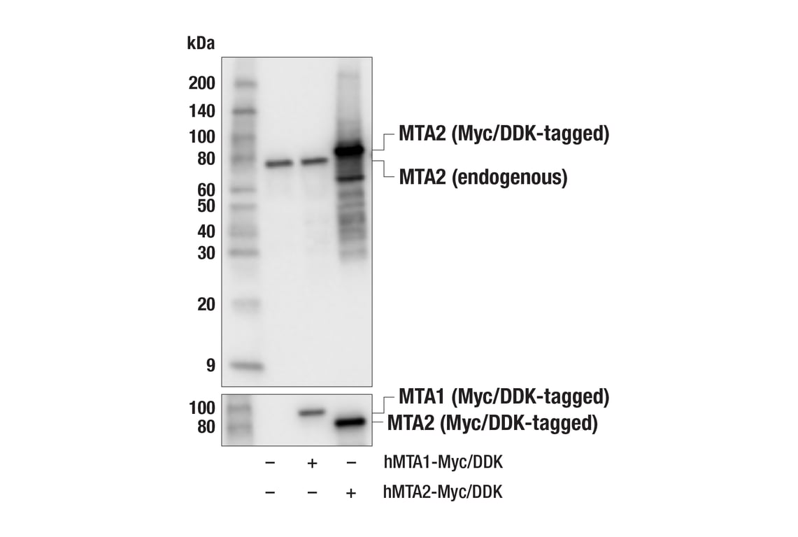 Western Blotting Image 2: MTA2 (F2D5U) Rabbit Monoclonal Antibody