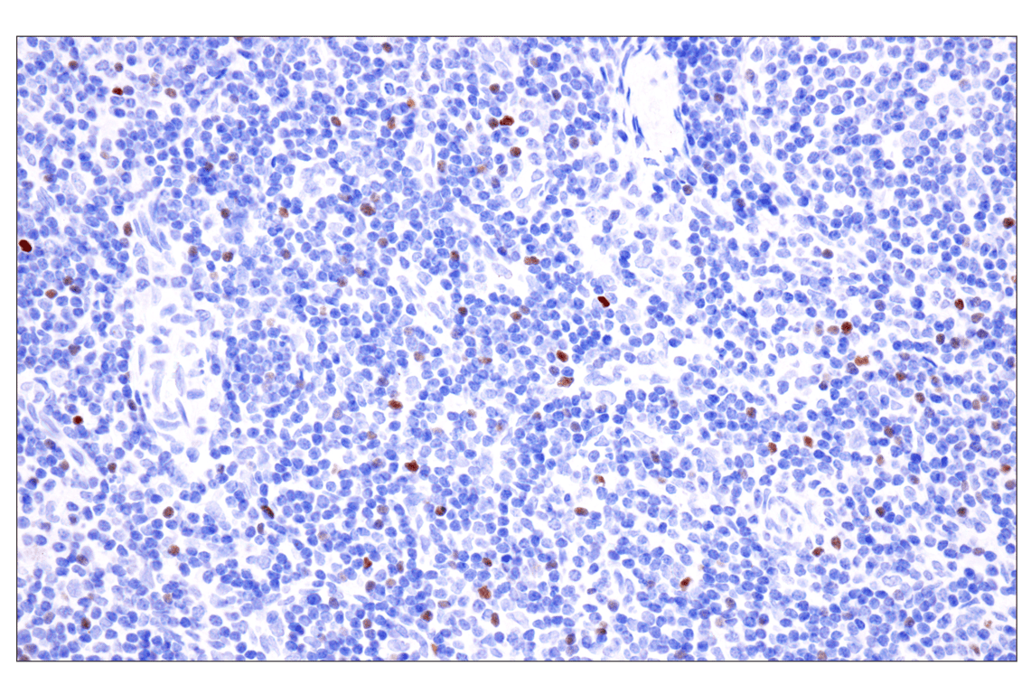 Immunohistochemistry Image 9: FoxP3 (221D) Mouse Monoclonal Antibody