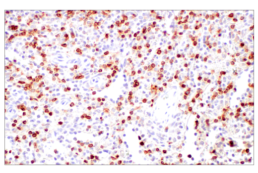Immunohistochemistry Image 8: CD2 (D6V9F) Rabbit Monoclonal Antibody