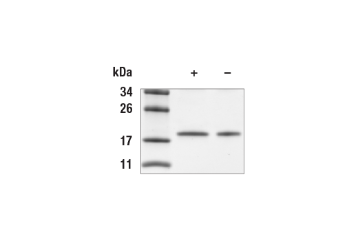 undefined Image 2: Human IL-1 beta Recombinant Protein