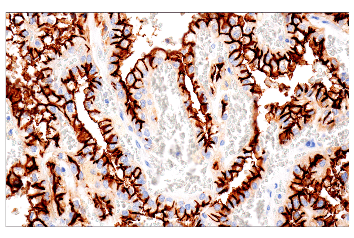 Immunohistochemistry Image 1: NaPi2b/SLC34A2 (D6W2G) Rabbit Monoclonal Antibody