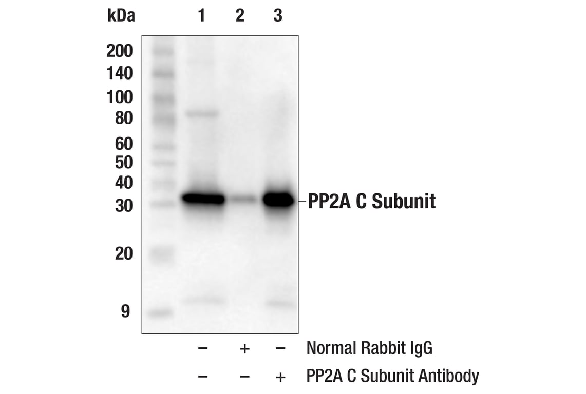 Immunoprecipitation Image 1: PP2A C Subunit Antibody