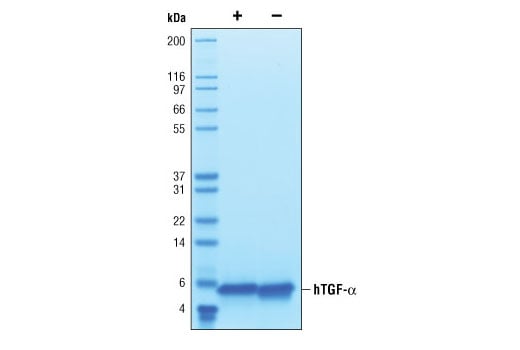 undefined Image 2: Human Transforming Growth Factor alpha (hTGF-alpha)