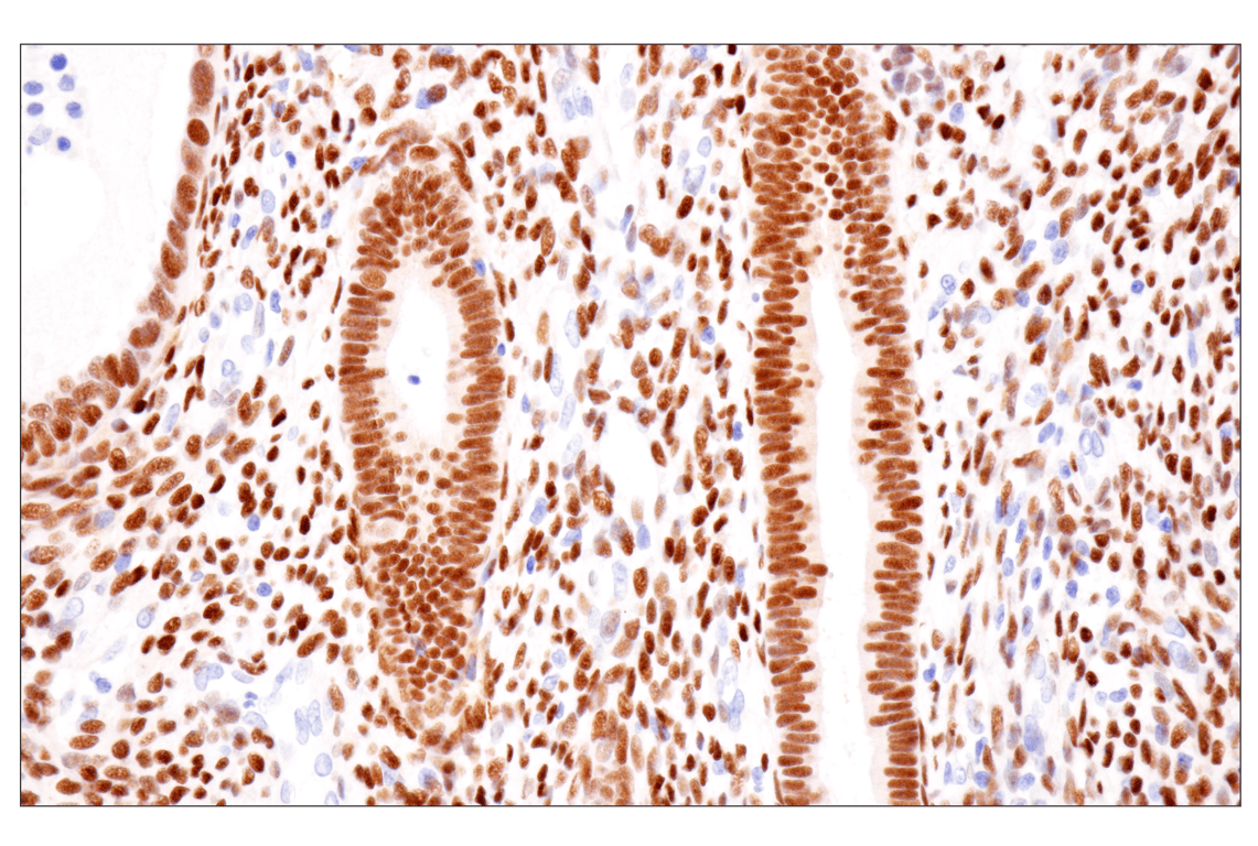 Immunohistochemistry Image 7: Estrogen Receptor alpha (D8H8) Rabbit Monoclonal Antibody