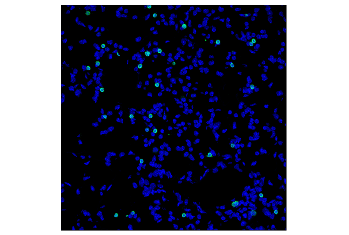 Immunofluorescence Image 2: CD79A (F3Z1H) Rabbit Monoclonal Antibody
