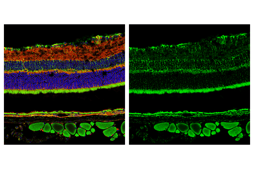 Immunofluorescence Image 4: MAVS (E8Z7M) Rabbit Monoclonal Antibody
