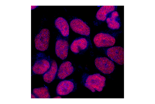 Immunofluorescence Image 1: CREB (86B10) Mouse Monoclonal Antibody
