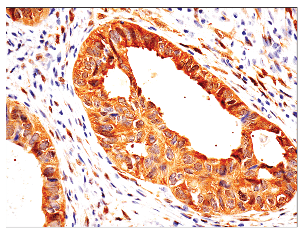 Immunohistochemistry Image 2: YAP (D8H1X) Rabbit Monoclonal Antibody
