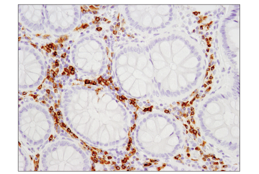 Immunohistochemistry Image 2: CD79B (D7V2F) Rabbit Monoclonal Antibody (BSA and Azide Free)