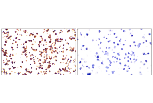 Immunohistochemistry Image 1: Integrin beta2 (E9O7W) Rabbit Monoclonal Antibody (BSA and Azide Free)