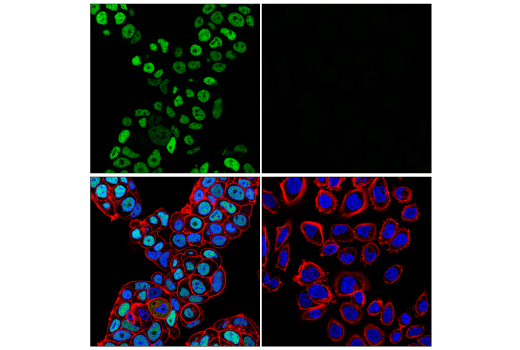 Immunofluorescence Image 1: ZHX2 (E5H5G) Rabbit Monoclonal Antibody