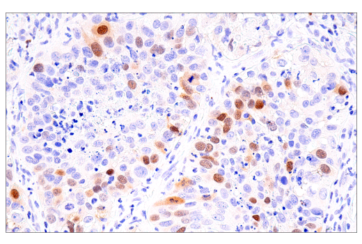 Immunohistochemistry Image 3: Cyclin A2 (E6D1J) Rabbit Monoclonal Antibody