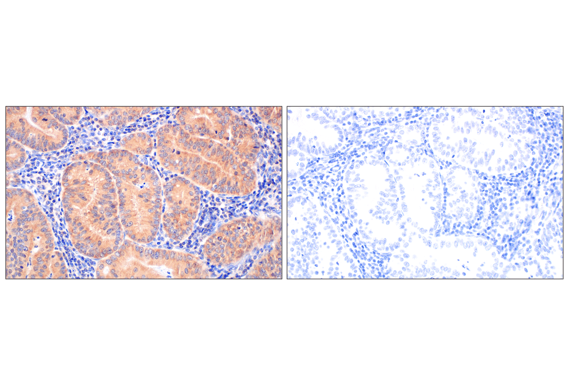 Immunohistochemistry Image 10: PIP4K2C (E7P3S) Rabbit Monoclonal Antibody