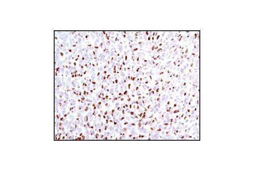 Immunohistochemistry Image 2: PU.1 (9G7) Rabbit Monoclonal Antibody (BSA and Azide Free)