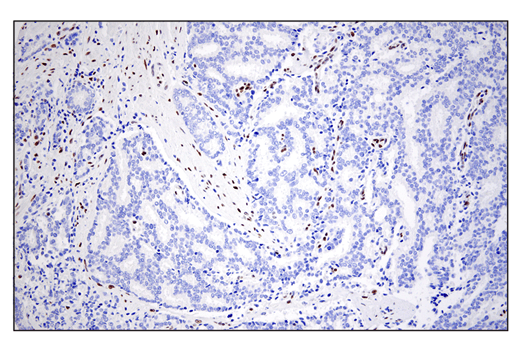 Immunohistochemistry Image 2: ZEB1 (E2G6Y) Rabbit Monoclonal Antibody (BSA and Azide Free)