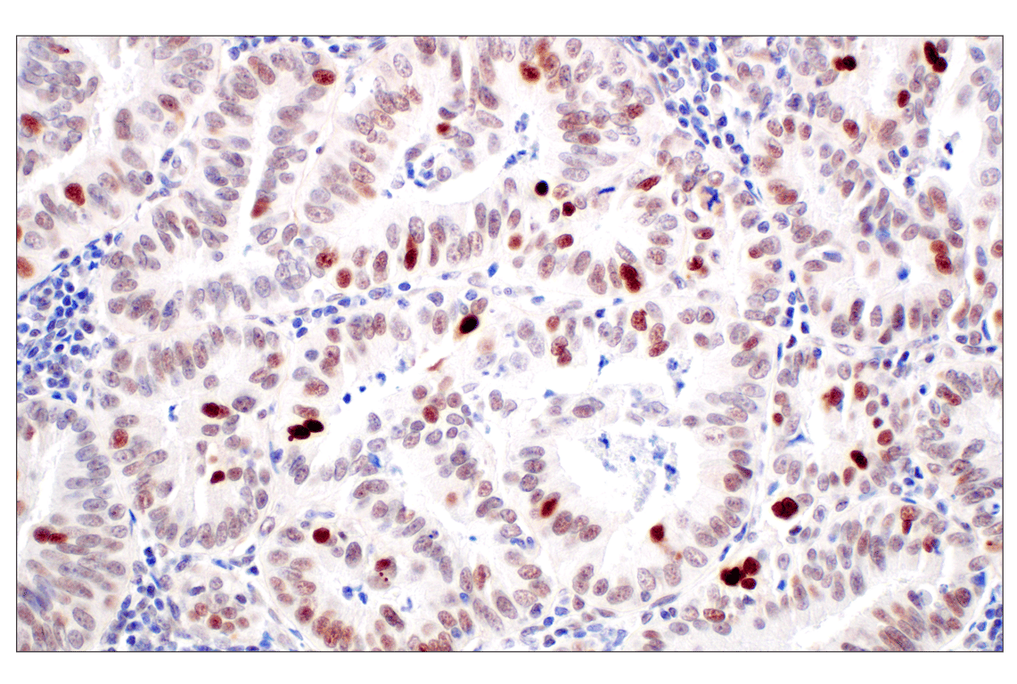 Immunohistochemistry Image 1: MDM2 (F7W7X) Rabbit Monoclonal Antibody (BSA and Azide Free)