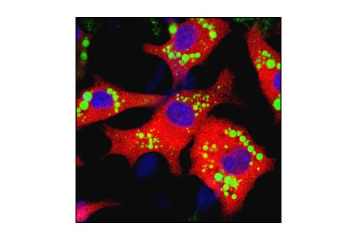 Immunofluorescence Image 1: SCD1 (C12H5) Rabbit Monoclonal Antibody