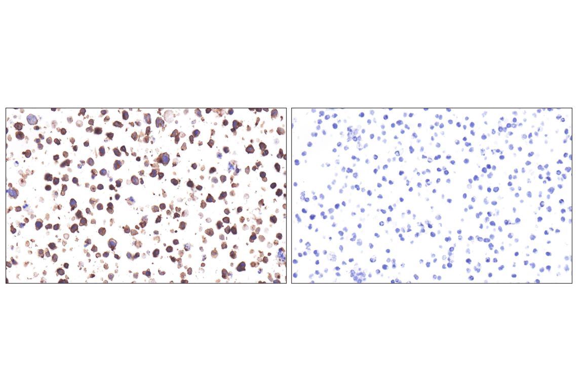 Immunohistochemistry Image 11: CCR4 (F9A9K) Rabbit Monoclonal Antibody