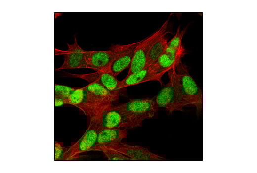 undefined Image 25: Rb Antibody Sampler Kit
