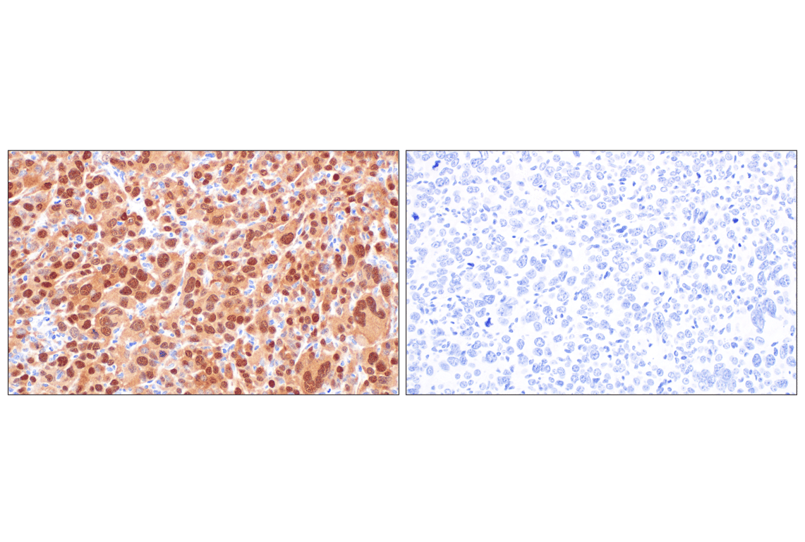 Immunohistochemistry Image 6: p16 INK4A (F2T7H) Rabbit Monoclonal Antibody