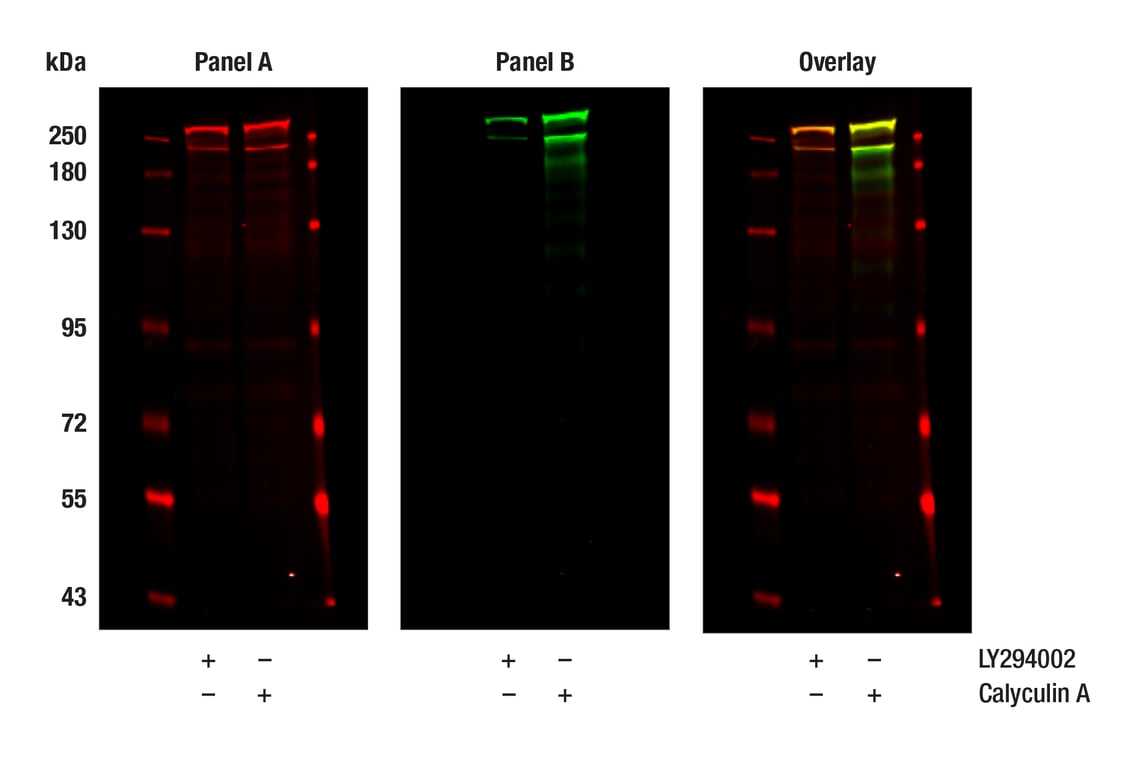 Western Blotting Image 1: mTOR (L27D4) Mouse Monoclonal Antibody