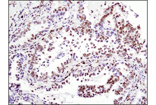 Immunohistochemistry Image 2: Glucocorticoid Receptor (D6H2L) Rabbit Monoclonal Antibody