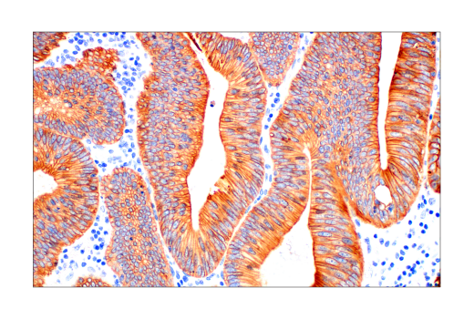 Immunohistochemistry Image 3: Pan-Keratin (AE1/AE3) Mouse Monoclonal Antibody